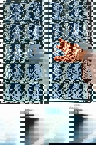 Foresight VCTs invest £4.6m into Hexarad Group Limited